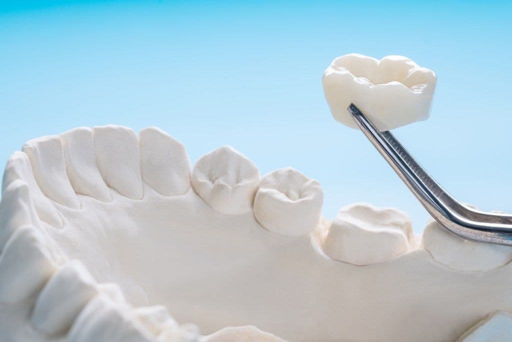 Signs Your Dental Restoration May Need Replacement